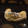 Grillz Custom in Gold | Grillz Grillz 8 Teeth Diamond Cut